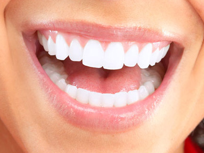 The image shows a close-up of a person s smiling mouth with white teeth, displaying a wide grin.