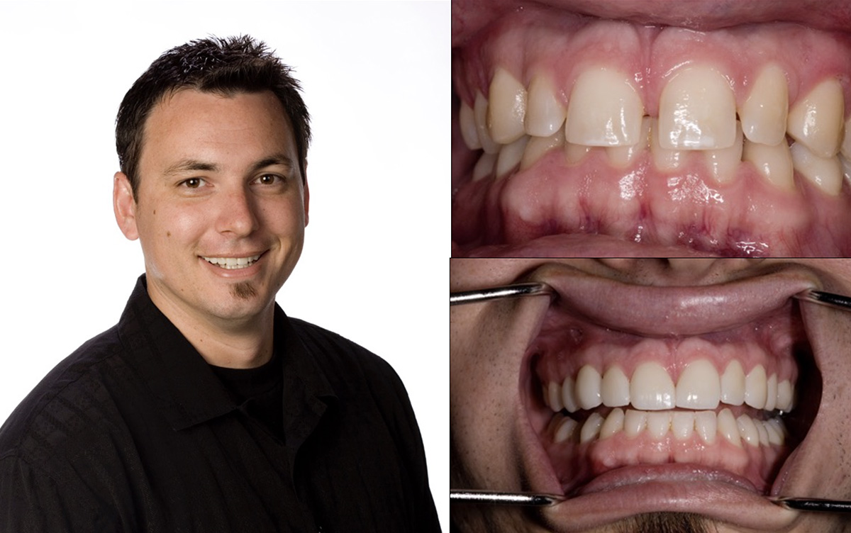 Valley Dental Esthetics | Cosmetic Dentistry, Ceramic Crowns and Emergency Treatment