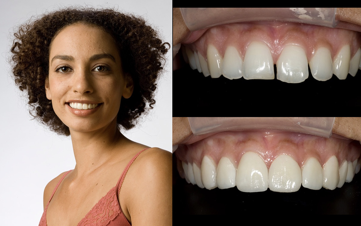 A woman with a wide smile, showcasing her teeth, against a white background.